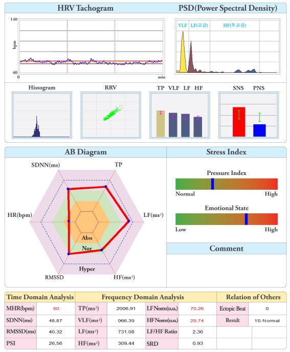 자율신경검사 예시 — 심박변이도(HRV) 분석